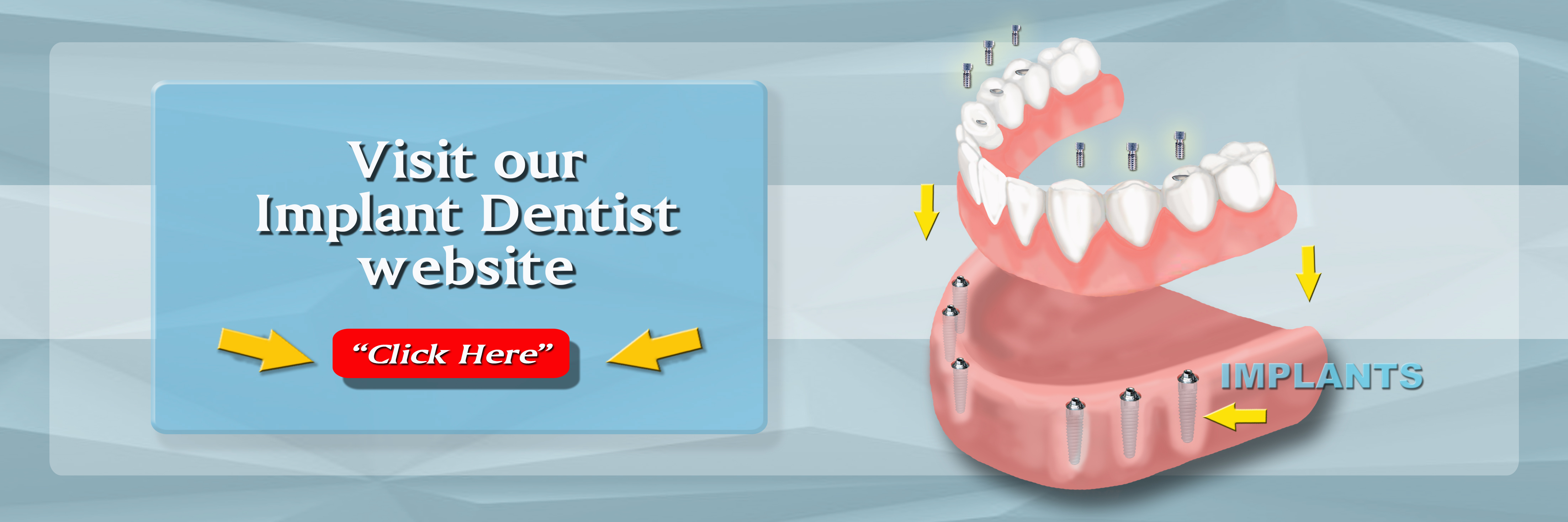 Dental Implants Kurpis Center For Implant and Cosmetic Dentistry
