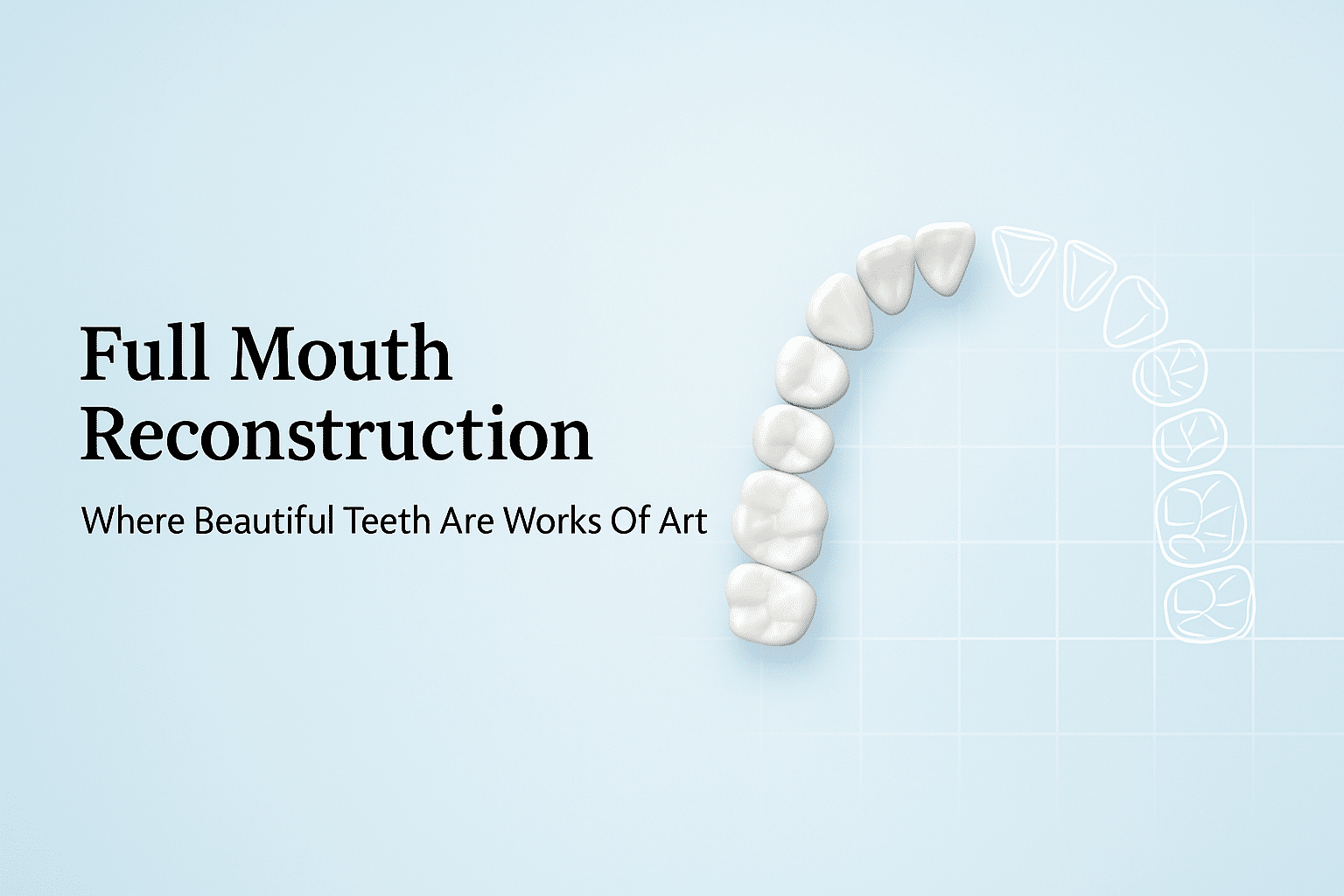 Missing Teeth Full Mouth Ridgewood NJ
