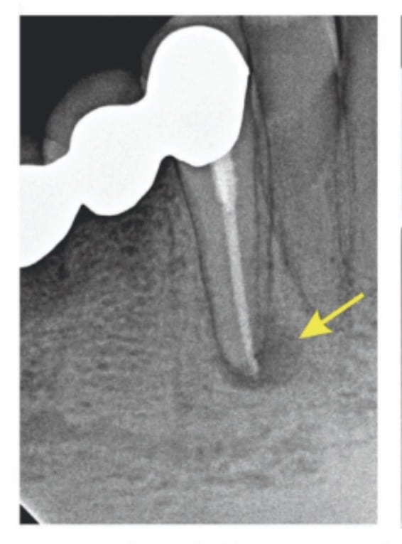 Regular X-Ray